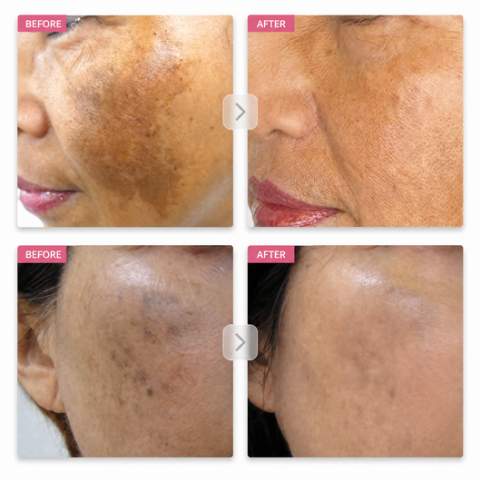 Arbutin 7% Brightening Cream — image 02