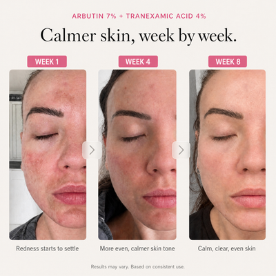 Arbutin 7% Brightening Cream — image 03