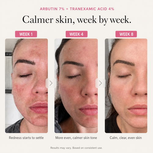 Arbutin 7% Brightening Cream