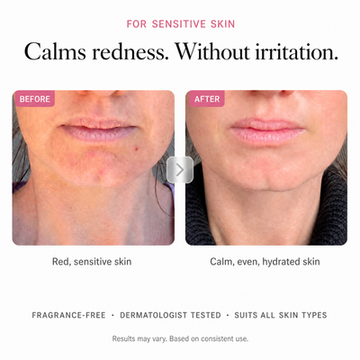 Arbutin 7% Brightening Cream — image 05