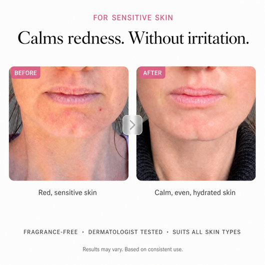 Arbutin 7% Brightening Cream — image 05