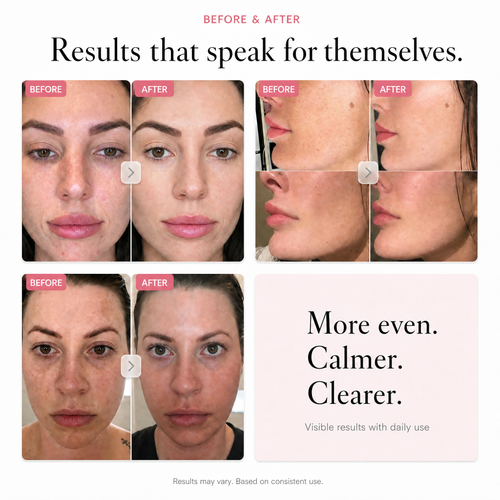 Arbutin 7% Brightening Cream