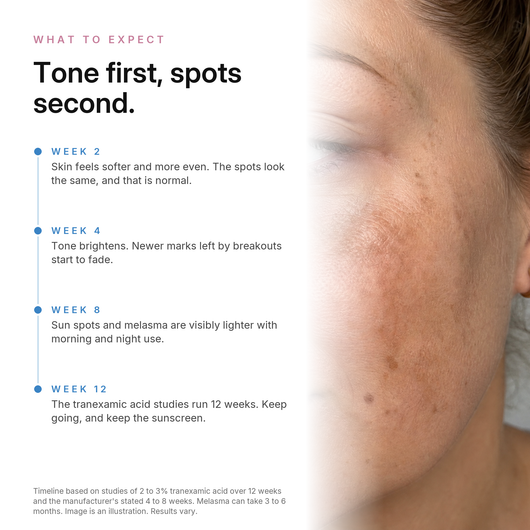 TXA Dark Spot Cream, what to expect