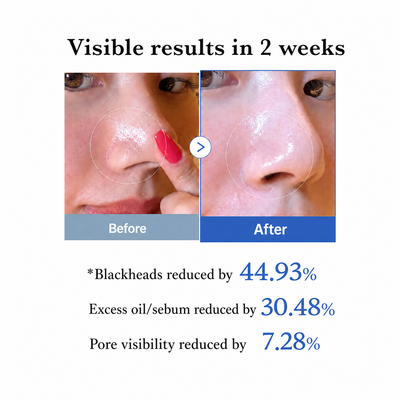 Zero Pore Pads — image 03